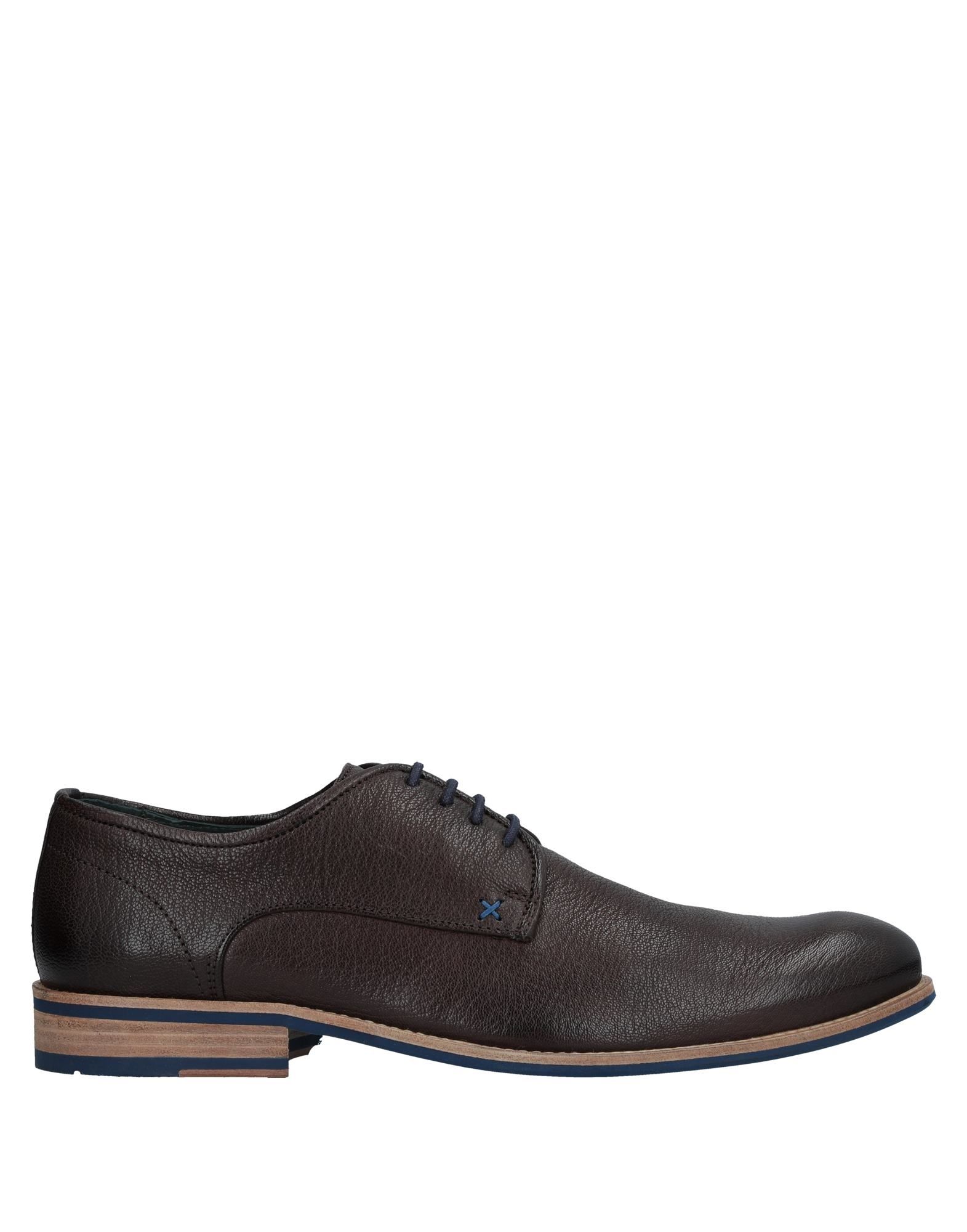 Stringate Exceed Uomo - 11521581MS Scarpe economiche e buone Stringate Exceed Uomo - 11521581MS Scarpe economiche e buone